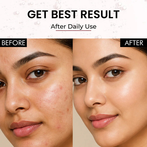 Snail Mucin: Skin Benefits, Side Effects, How to Use