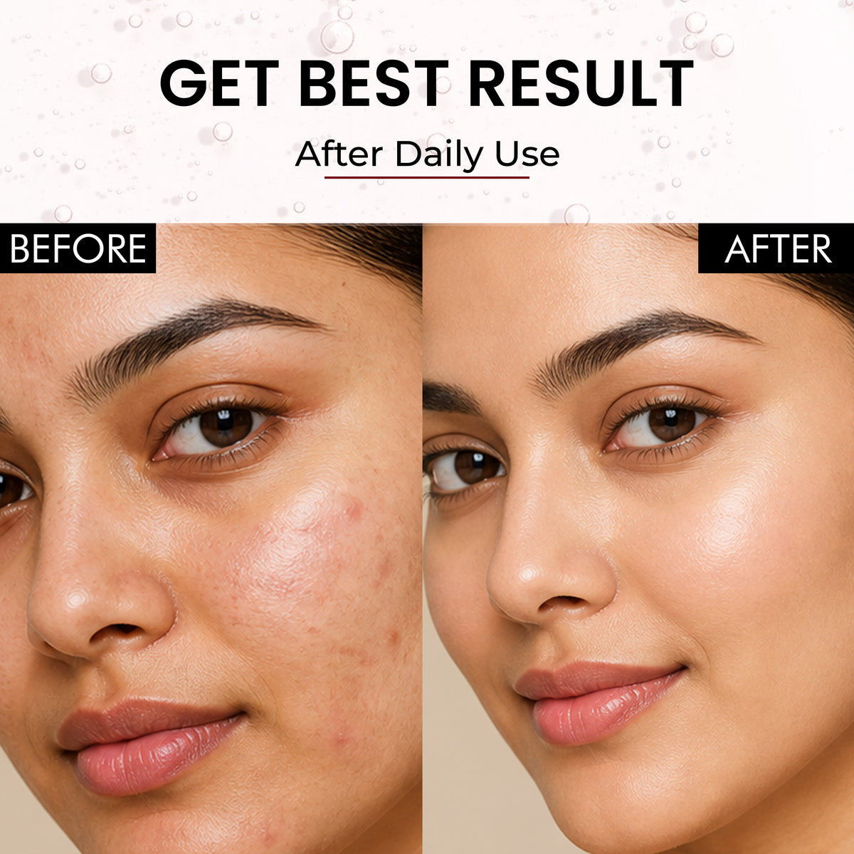 TrueBare SnailGlow Repair Serum – Snail Mucin Serum with Niacinamide & Hyaluronic Acid for Deep Hydration & Skin Repair