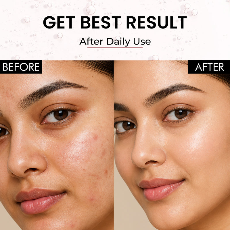TrueBare SnailGlow Repair Serum – Snail Mucin Serum with Niacinamide & Hyaluronic Acid for Deep Hydration & Skin Repair